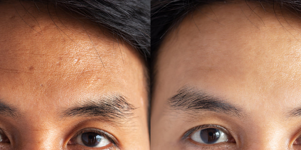 Facts About Skin Lighteners and Brighteners — Mitchell Brands Canada