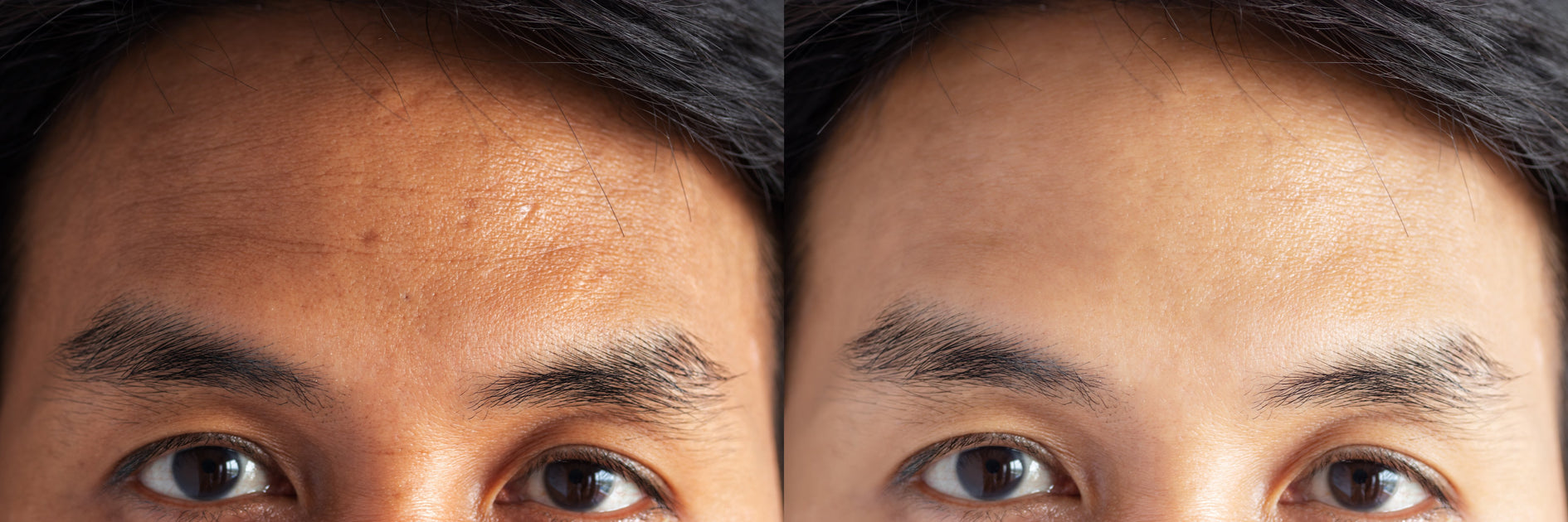 Facts About Skin Lighteners and Brighteners — Mitchell Brands Canada