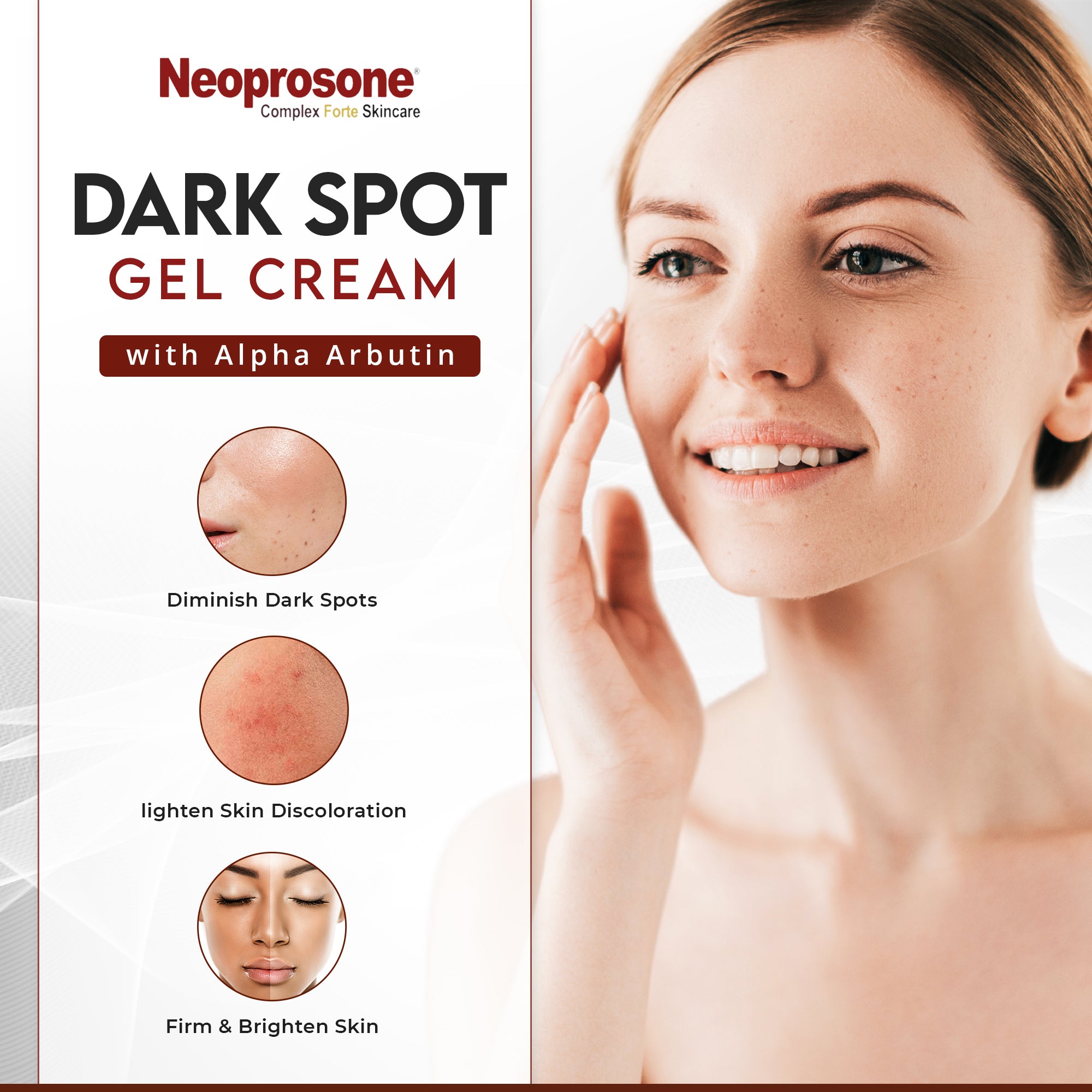 Gel-crème anti-taches US Neoprosone 30 ml