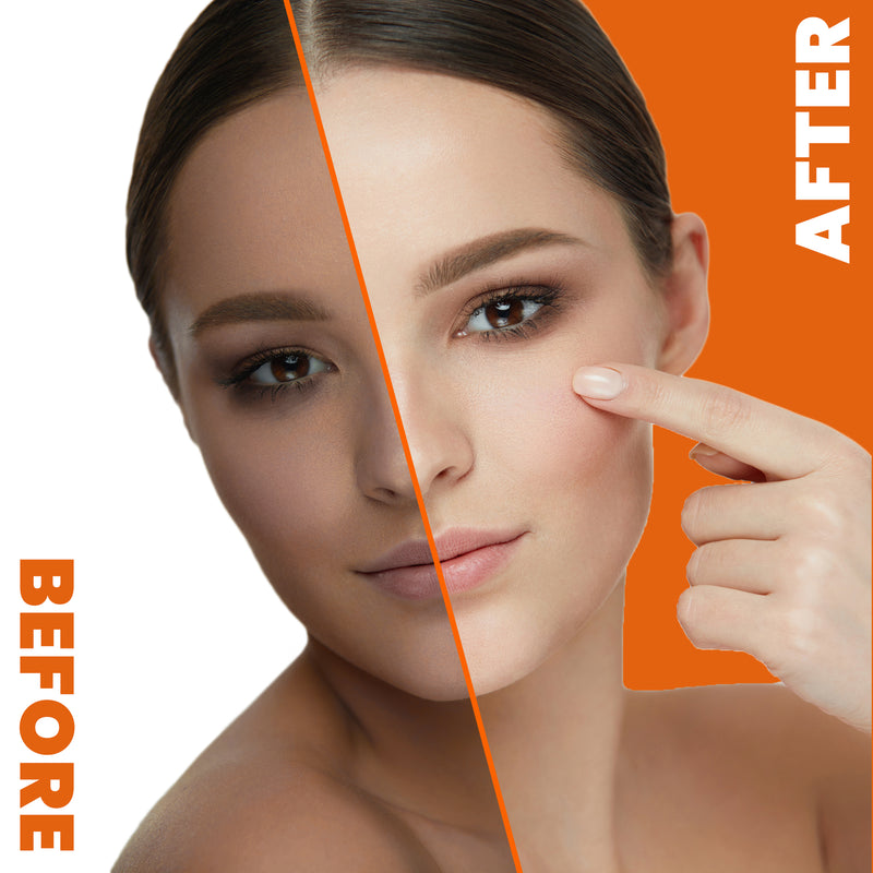 Gel Éclaircissant Néoprosone à la Vitamine "C" 30g 