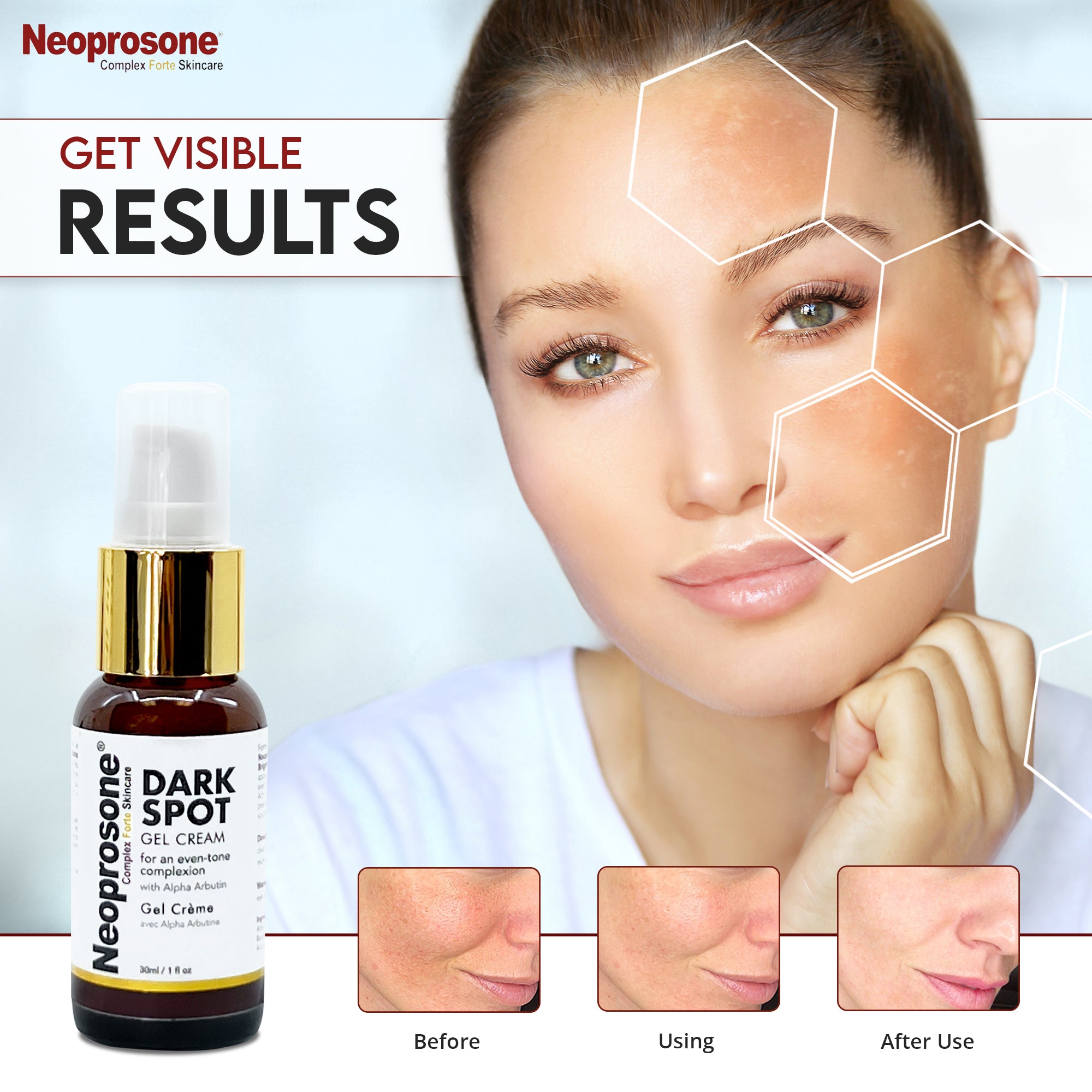 Gel-crème anti-taches US Neoprosone 30 ml
