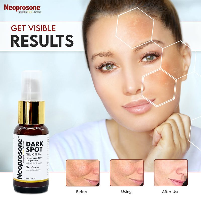Gel-crème anti-taches US Neoprosone 30 ml