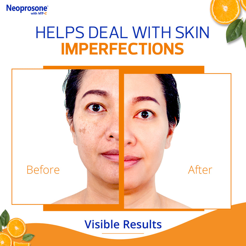 Neoprosone Vit C Crème Anti-Taches 30 ml 