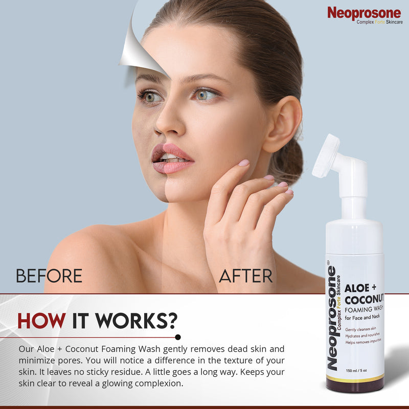 Neoprosone Foaming Wash With Aloe And Coconut 150ml / 5 fl oz