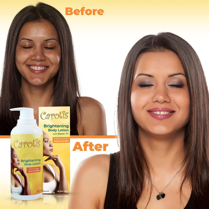 Carotis Brightening Body Lotion With Vitamin A 400ml / 14.10 fl oz